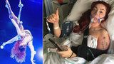Sexy akrobatka, která se ráda vyprsuje: Při hororovém pádu si zlomila klíční kost
