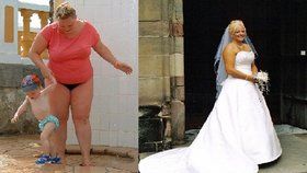 Žena se snažila několikrát zhubnout pomocí nejrůznějších diet, nakonec ale musela podstoupit bandáž žaludku.