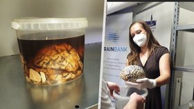 Naděje pro nemocné s demencí. V Thomayerově nemocnici otevřela první mozková banka v Česku