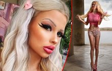 První česká Barbie Jiráčková (18): PŘEPADENA! Jednali s ní jako s odpadem!