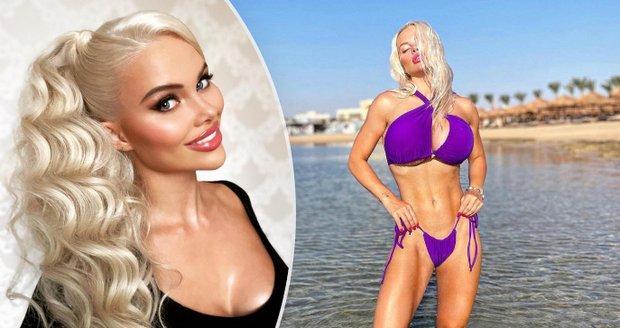 »Česká Barbie« Gabriel Jiráčková ukázala výsledek poslední plastiky: Otok konečně splasknul!
