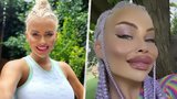 Česká Barbie Jiráčková: Po ztrátě bradavky fialové vlasy a obří rty!