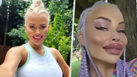 Česká Barbie Jiráčková: Po ztrátě bradavky fialové vlasy a obří rty!