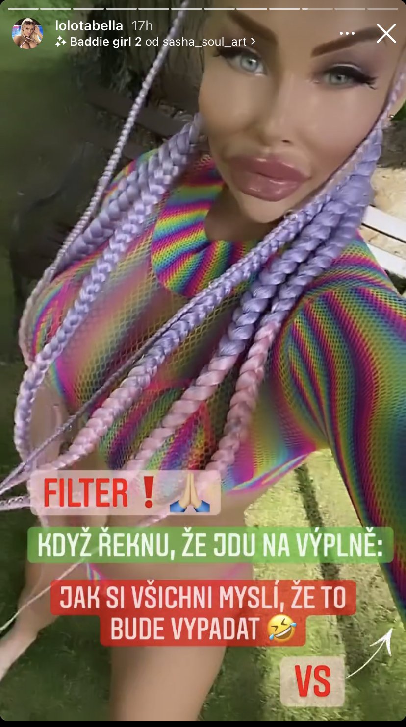 Česká Barbie Jiráčková vyděsila fanoušky filtrem se zvětšenými rty.