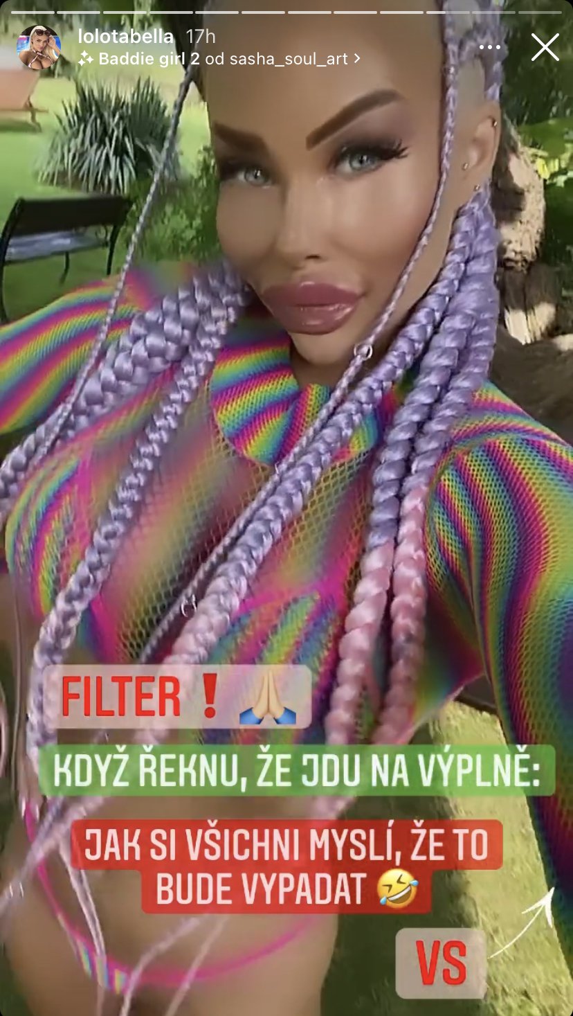 Česká Barbie Jiráčková vyděsila fanoušky filtrem se zvětšenými rty.