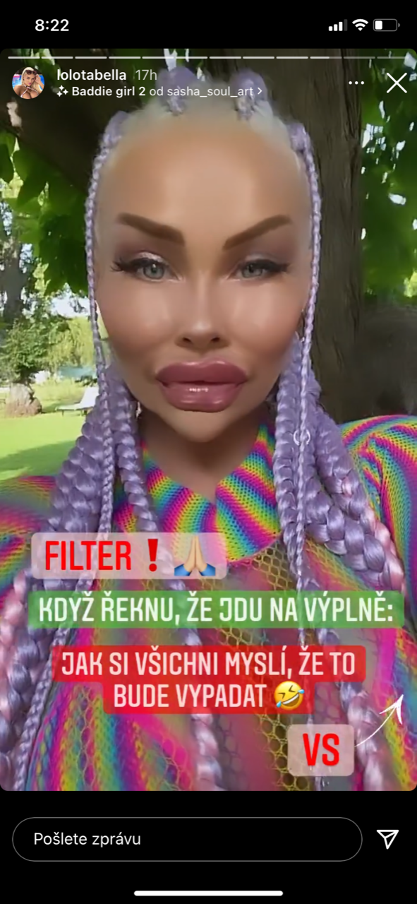 Česká Barbie Jiráčková vyděsila fanoušky filtrem se zvětšenými rty.