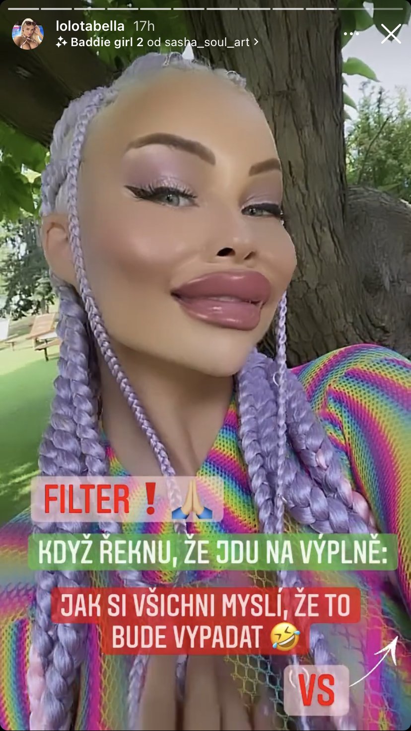 Česká Barbie Jiráčková vyděsila fanoušky filtrem se zvětšenými rty.