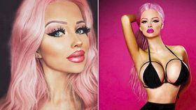 Česká Barbie Jiráčková o své narušené psychice: Chtěla jsem se zabít