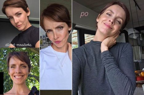 Obrázek: Lašková podlehla estetické medicíně! Co si nechala odstranit?