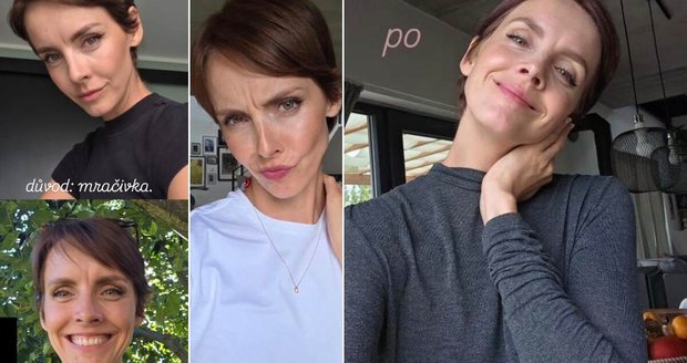 Gabriela Lašková se pomocí botoxu zbavila své "mračivky"