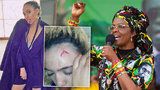 Myslela jsem, že zemřu: Žena afrického miliardáře a diktátora Mugabeho drsně zbila sexy modelku