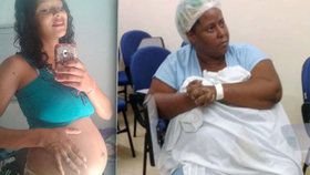 Žena, která potratila miminko, vyřízla nenarozené dítě osmnáctileté dívce z břicha.