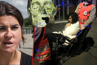 Ženě ISIS ustřelil kus tváře: Polykala vlastní zuby a hrála mrtvou. Zázrakem přežila