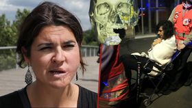 Ženě ISIS ustřelil kus tváře: Polykala vlastní zuby a hrála mrtvou. Zázrakem přežila