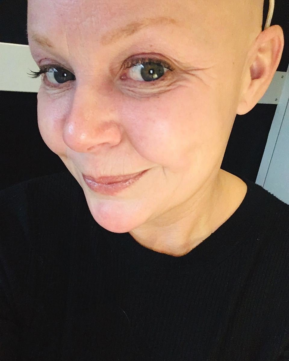 Gail Porter, bývalá partnerka Keitha Flinta, nyní bojuje s rakovinou