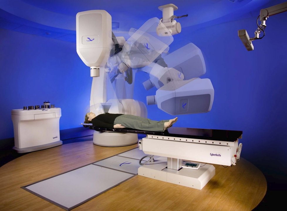 CyberKnife - neboli gama nůž by mohl neinvazivně pomoci s léčbou a operacemi nejen mozkových nádorů