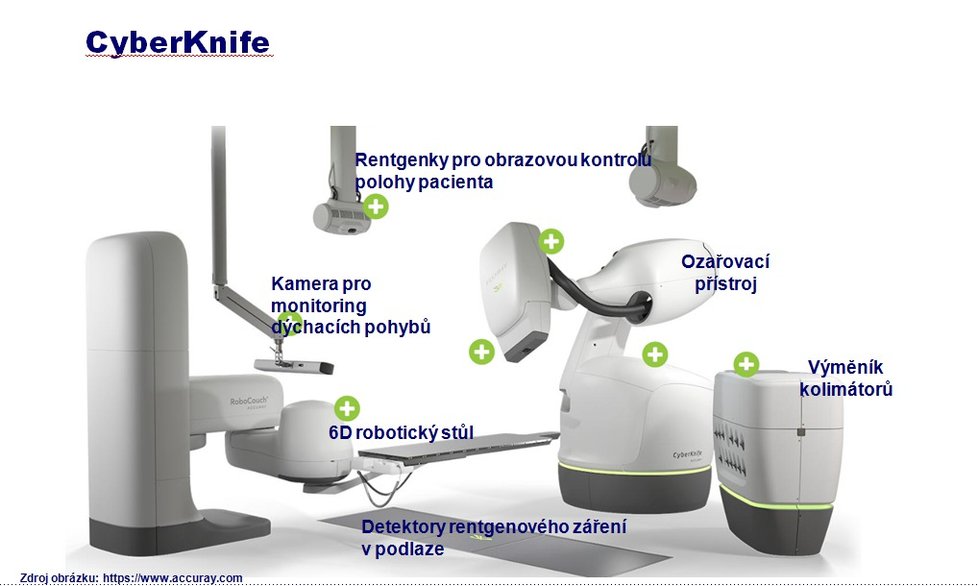 CyberKnife - neboli gama nůž by mohl neinvazivně pomoci s léčbou a operacemi nejen mozkových nádorů