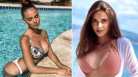 Gašpárová z Love Islandu přiznala: Bulimie, anorexie a zpackaná plastika prsou!
