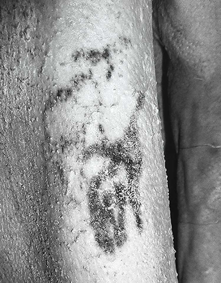 Tetování muže z Gebeleinu zobrazuje pratura