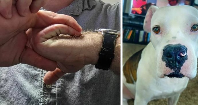 13 lidí, kteří jsou hříčkou přírody! Co jim chybí, nebo naopak přebývá?