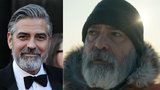 George Clooney v bolestech v nemocnici: Vážná diagnóza! Kvůli špatné životosprávě!