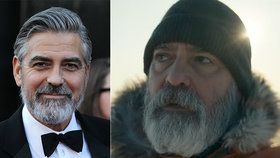 George Clooney v bolestech v nemocnici: Vážná diagnóza! Kvůli špatné životosprávě!