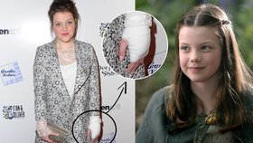 Georgie Henley se rozhovořila o svých jizvách.