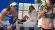 Tenistka Nicole Gibbsováse při běžné zubní prohlídce dozvěděla drsnou zprávu...