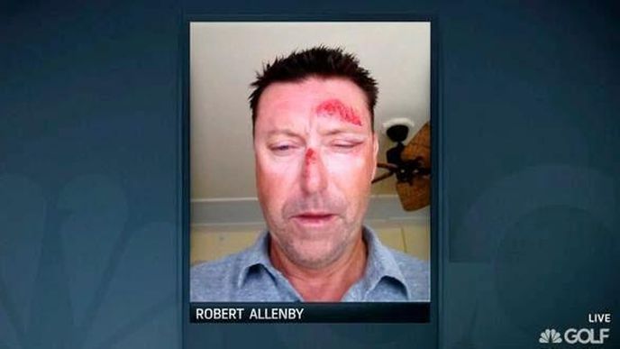 Známý golfista Allenby byl unesen, zbit a okraden. Na nic si nepamatuje