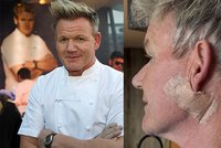 Šéfkuchař Gordon Ramsay (58) šokoval fanoušky: Bojuju s rakovinou!