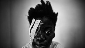 Porota tři dny probírala více než 4 tisíce fotek, aby se nakonec rozhodla pro tuto. Jde o dívku ošetřenou v nemocnici v Port-au-Prince na Haiti. „Obraz je ohromující a silně působivý,“ shodla se porota.