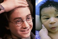 Holčička se narodila s bleskem na čele: Je z ní nadšená i autorka Harryho Pottera