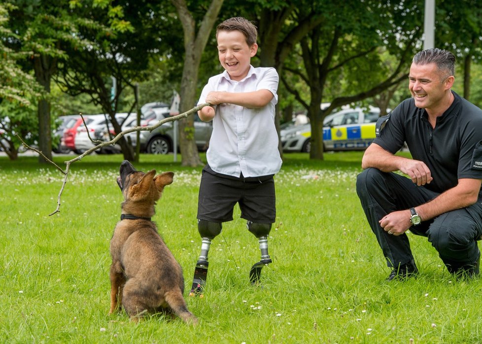 Harveymu nové lepší protézy pořídila policie jeho rodného města.