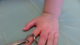 Kuriózní zásahy hasičů: 4leté holčičce uvízl na prstu klíč.