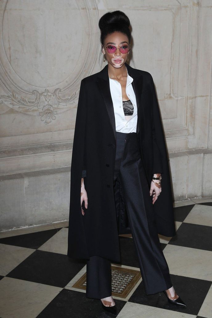 Winnie Harlow Winnie Harlow