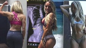 Hvězda Instagramu Hayley Wakefield se nenechala operovat, i když jí lékaři varovali, že může bez zákroku zemřít.