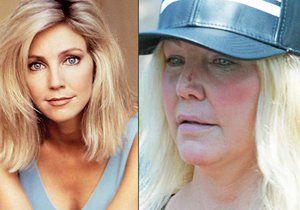 Heather Locklear se hodně změnila.