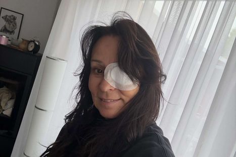 Obrázek: Jednooká Heidi Janků: Brutální šedý zákal, tvrdí doktor!
