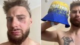 Jakuba napadli v Ostravě kvůli modrožlutému kloboučku: Jel na kole v barvách Horního Slezska