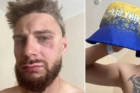 Jakuba napadli v Ostravě kvůli modrožlutému kloboučku: Jel na kole v barvách Horního Slezska