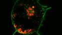 Geneticky upravené HeLa buňky, které produkují fluorescenčně zbarvený protein.