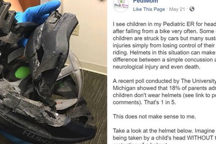 Pediatr ukazuje drsnou fotku a varuje: Nikdy nenechte děti jezdit bez helmy! 