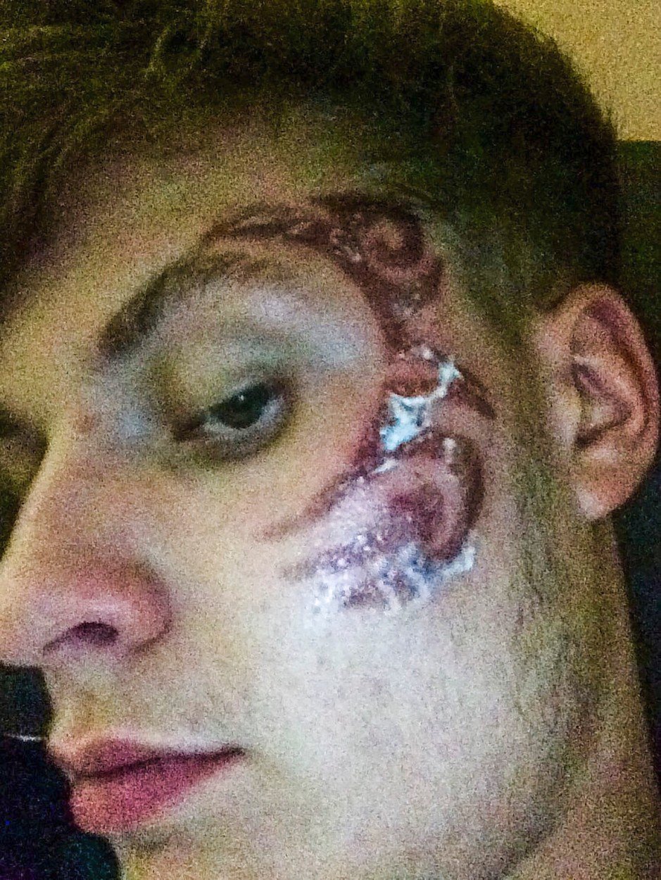 James Colley si nechal udělat na obličeji „tetování“ hennou jako má Mike Tyson. Skončil s nateklou hlavou a bolestmi.