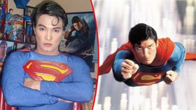 Herbert Chavez se plastickými operacemi snaží přiblížit svému idolu Supermanovi.