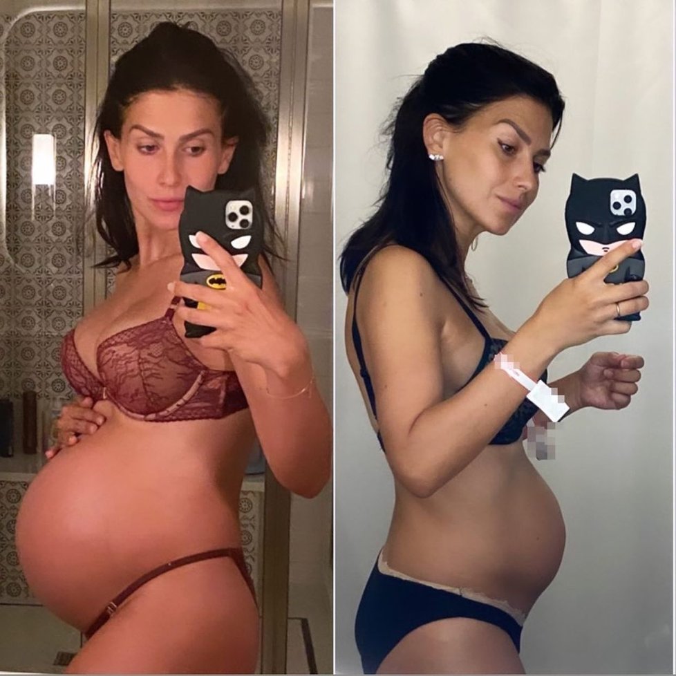 Hilaria Baldwin před a po porodu