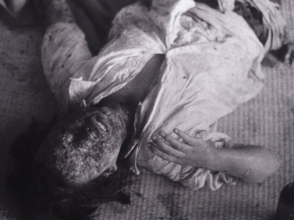 Památník v Hirošimě: Dobové foto lidí, kteří utrpěli zranění během jaderné exploze