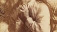Historické fotografie žen diagnostikované s hysterií v různých fázích této chorby