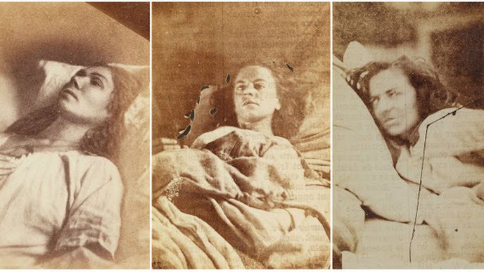 Historické fotografie žen diagnostikované s hysterií v různých fázích této chorby