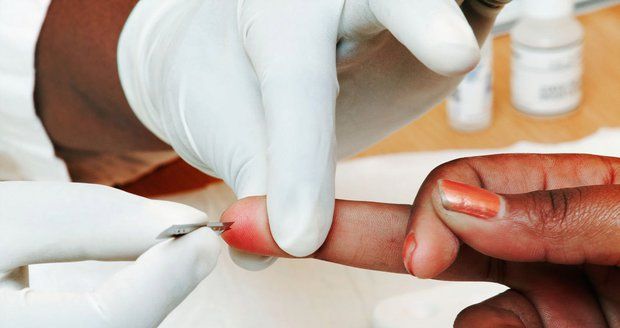 Počet nových případů HIV klesá: Za prvních 7 měsíců jen 152 nakažených 