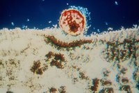 Vědci objevili nakažlivější variantu HIV: Má větší virovou nálož a více škodí imunitě